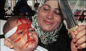 A mother rejoices after inflicting wounds on the head of her toddler 